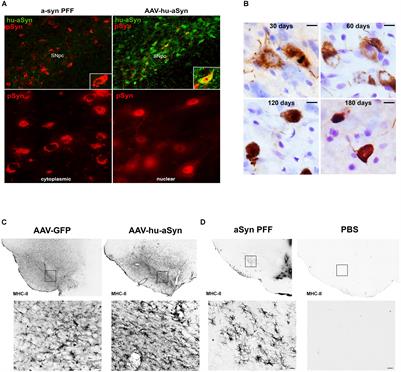 Quality Over Quantity: Advantages of Using Alpha-Synuclein Preformed Fibril Triggered Synucleinopathy to Model Idiopathic Parkinson’s Disease